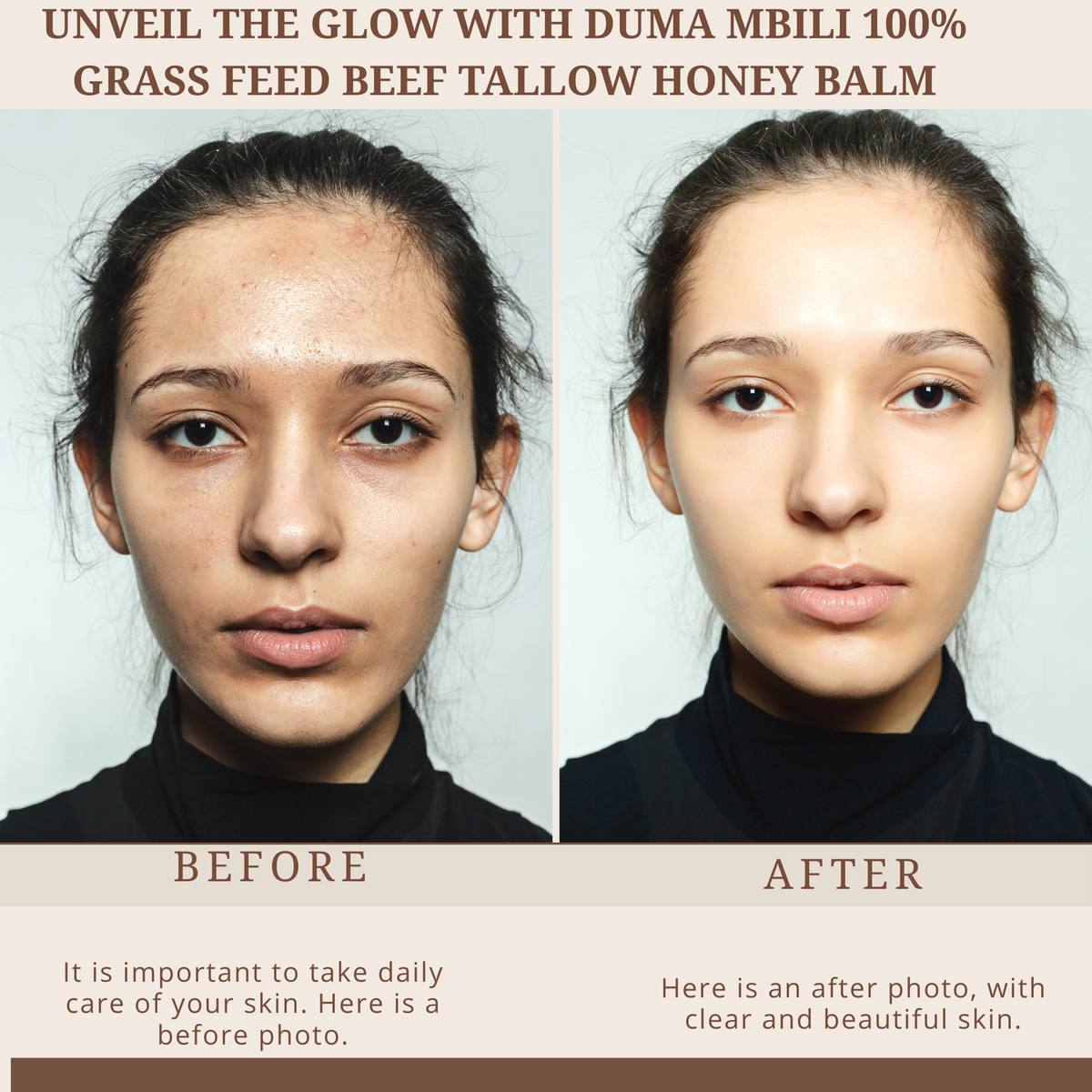 Duma Mbili 100% Grass-Fed Tallow & Honey Balm